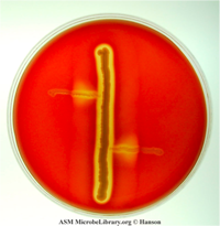 Staphylococcus aureus